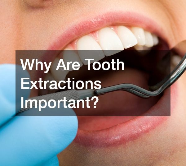 Why Are Tooth Extractions Important?