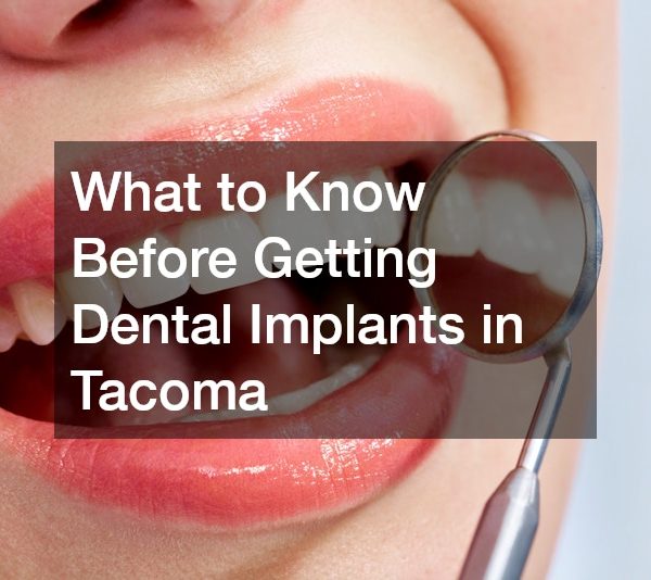 What to Know Before Getting Dental Implants in Tacoma