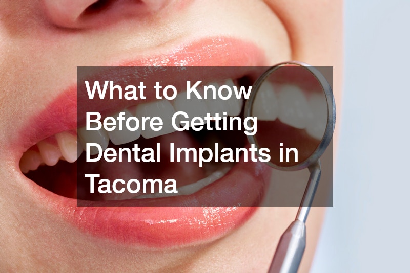 What to Know Before Getting Dental Implants in Tacoma