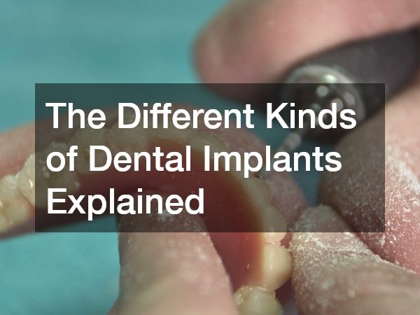 The Different Kinds of Dental Implants Explained