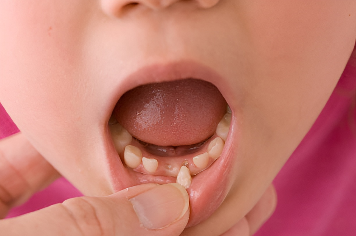 adult looking at a girl's loose tooth