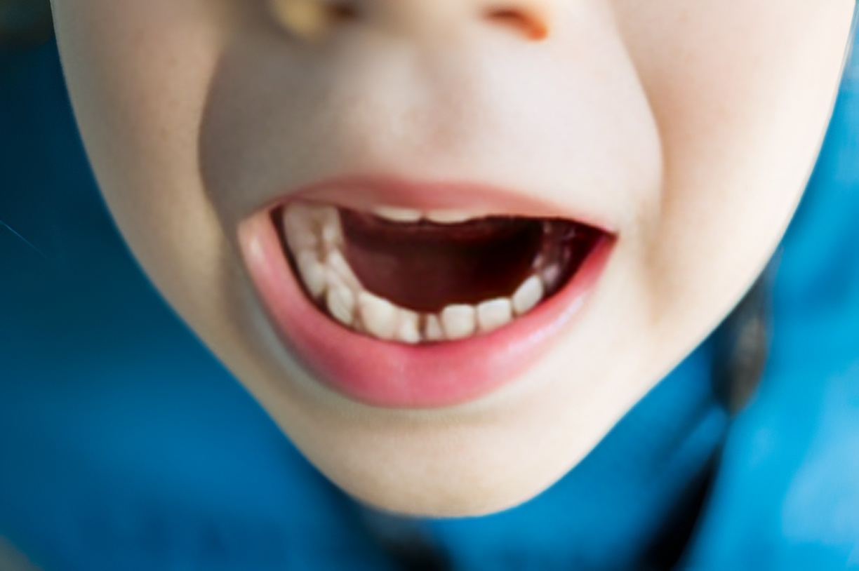 boy with a missing front tooth